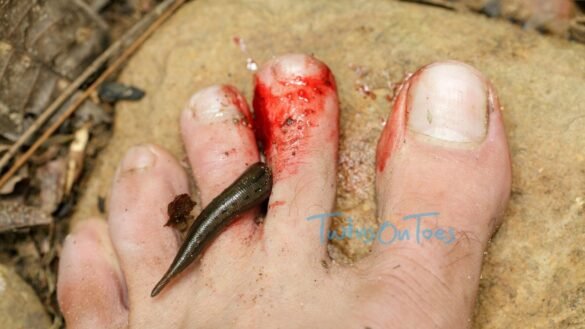Getting rid of the leeches while hiking during monsoons